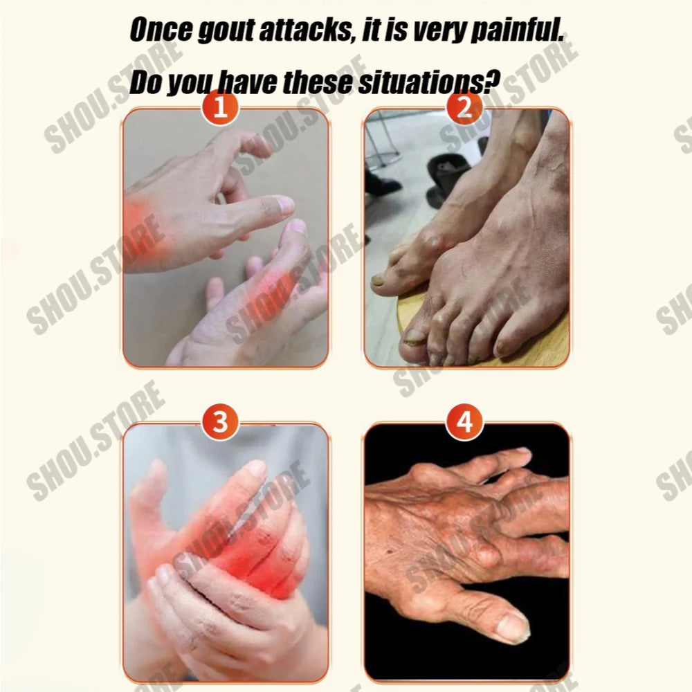 Japan Gout Care Patch Quick Pain Relief ( BUY 1 GET 1 FREE )